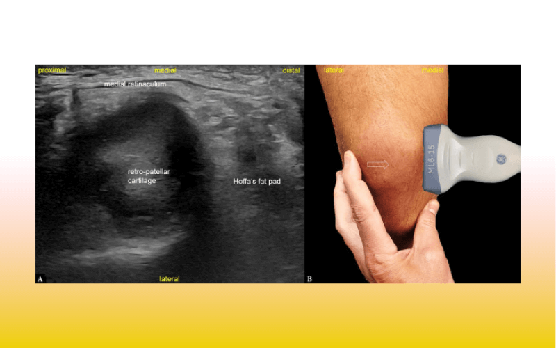 6. Compartimento anterior rodilla tempo formacion.png